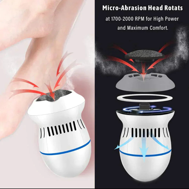 Amaryllis Electric Callus Remover